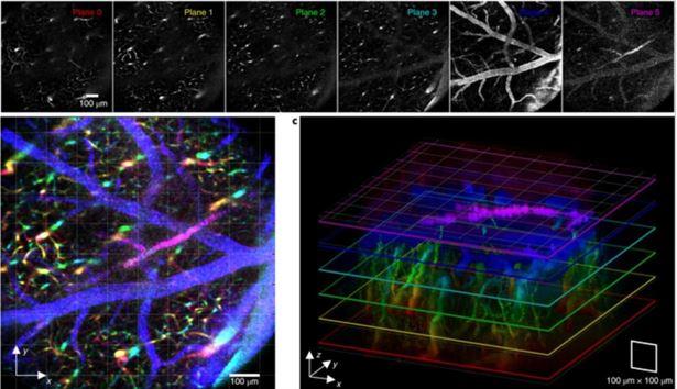 6-plane vasculature imaging 